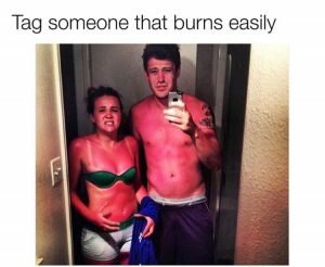 Burnt skin summer memes